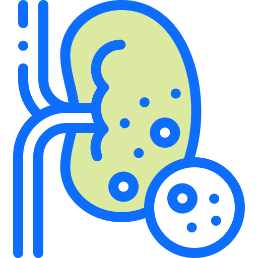 kidney-tranplant